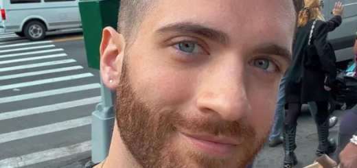 美国首位公开猴痘患者、洛杉矶男同性恋主播自述:疼的睡不着